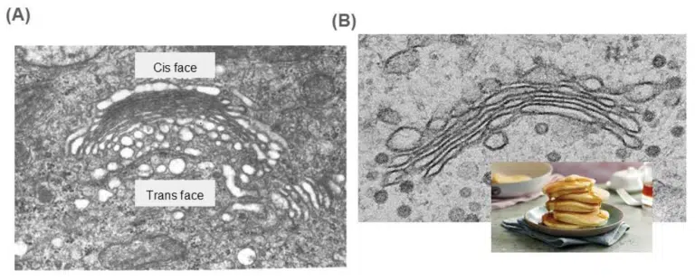 Two grayscale electron microscope images of the Golgi apparatus; one has labels "Cis face" and "Trans face," the other includes a small inset photo of pancakes.