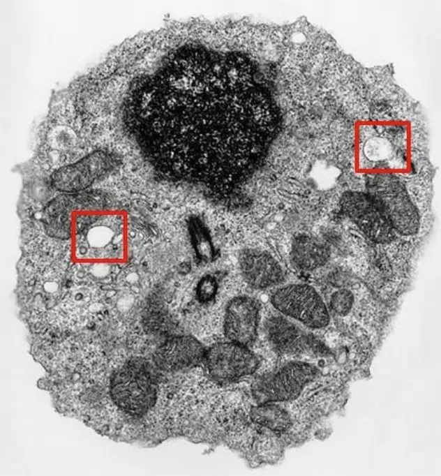 Black and white microscopic image of a cell with several organelles visible; two areas are highlighted with red squares for emphasis.
