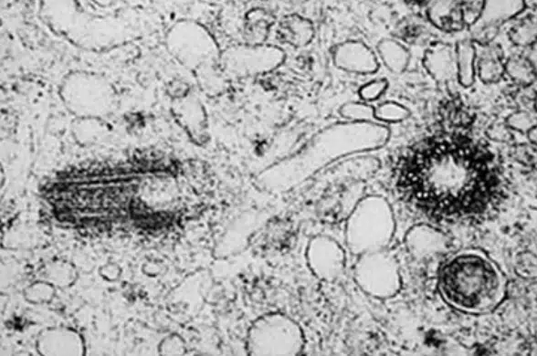 Black and white electron microscope image shows cellular structures with various round and elongated shapes, including dense dark areas and lighter regions scattered throughout.