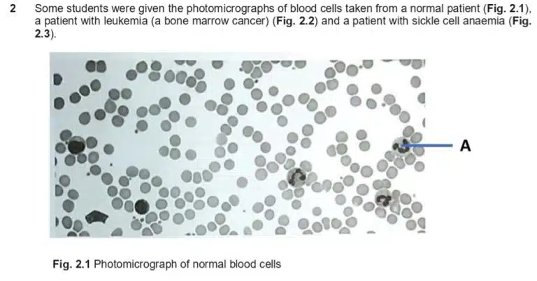 Photomicrograph showing various sizes and shapes of normal blood cells scattered across a white background.